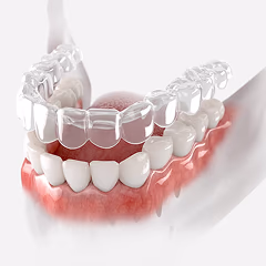Orthodontic treatment 