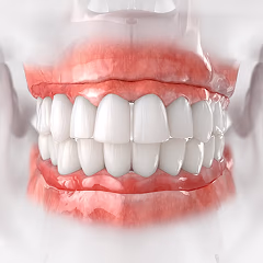 Teeth whitening 