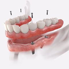 Surgical dentistry