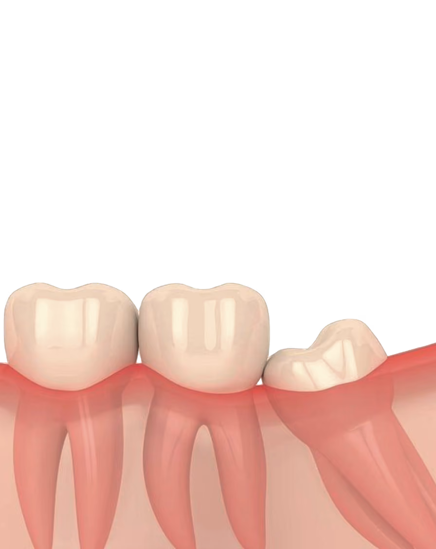 Dental tool polishing white teeth with pink gums visible underneath.