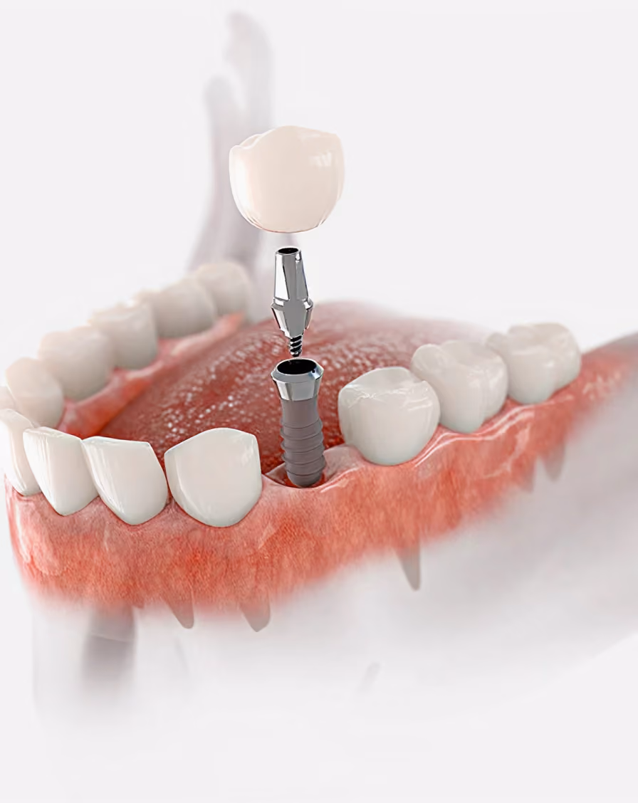 Dental tool polishing white teeth with pink gums visible underneath.
