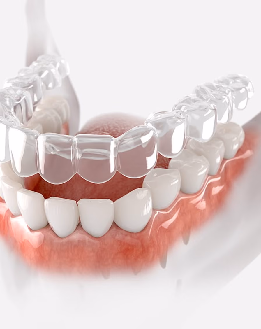 Dental tool polishing white teeth with pink gums visible underneath.
