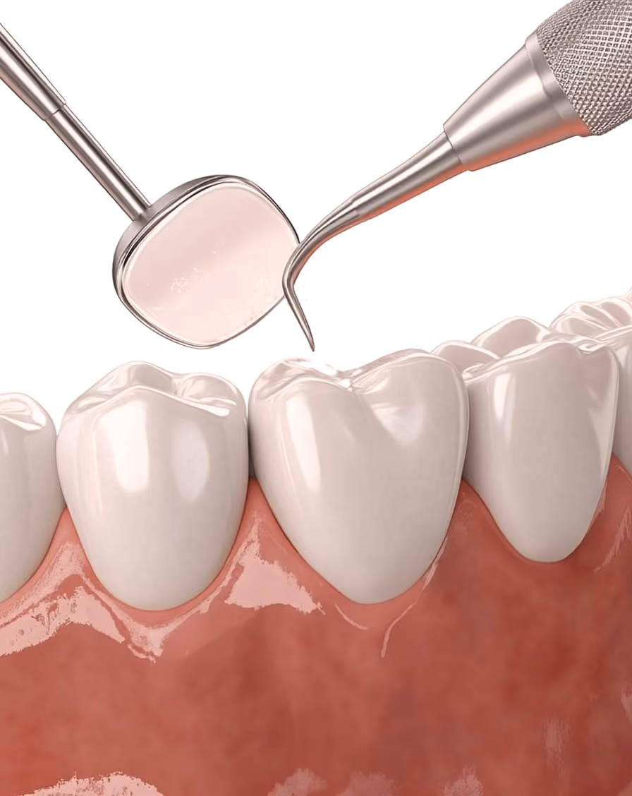 Dental tool polishing white teeth with pink gums visible underneath.