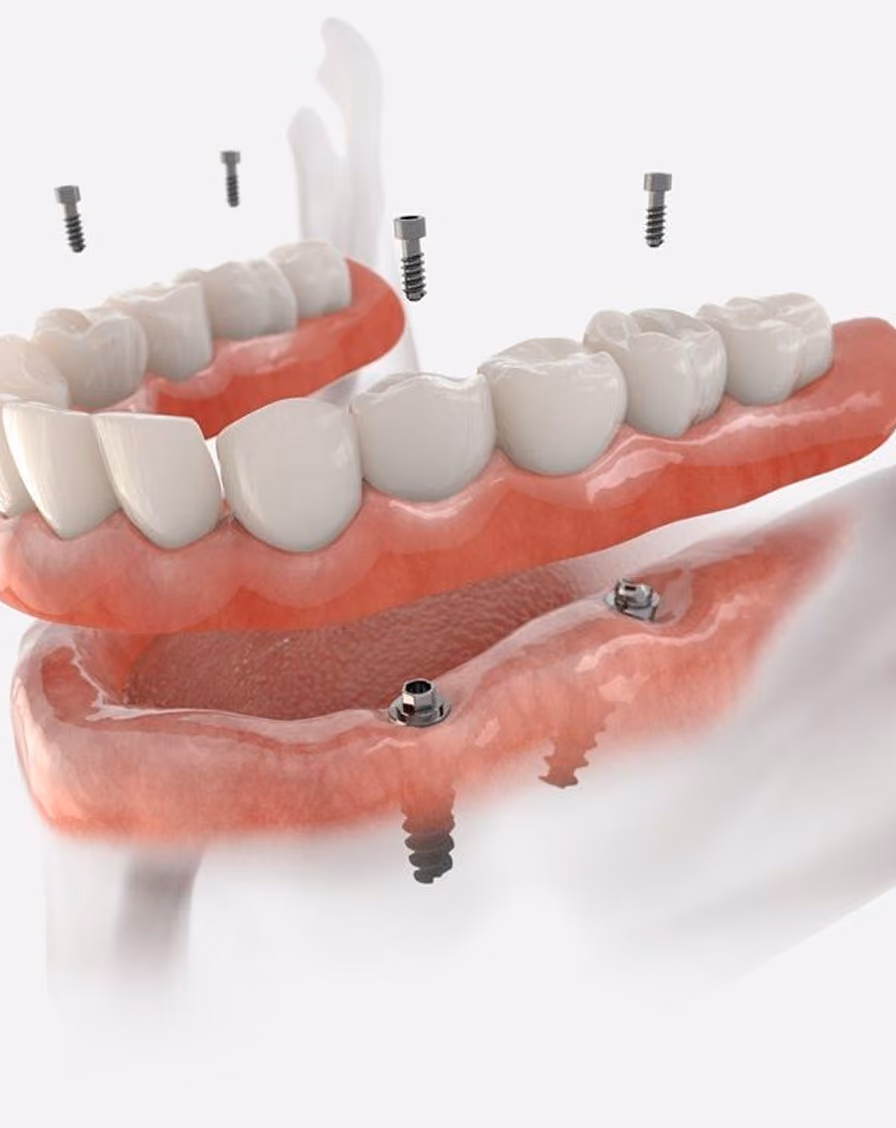 Dental tool polishing white teeth with pink gums visible underneath.