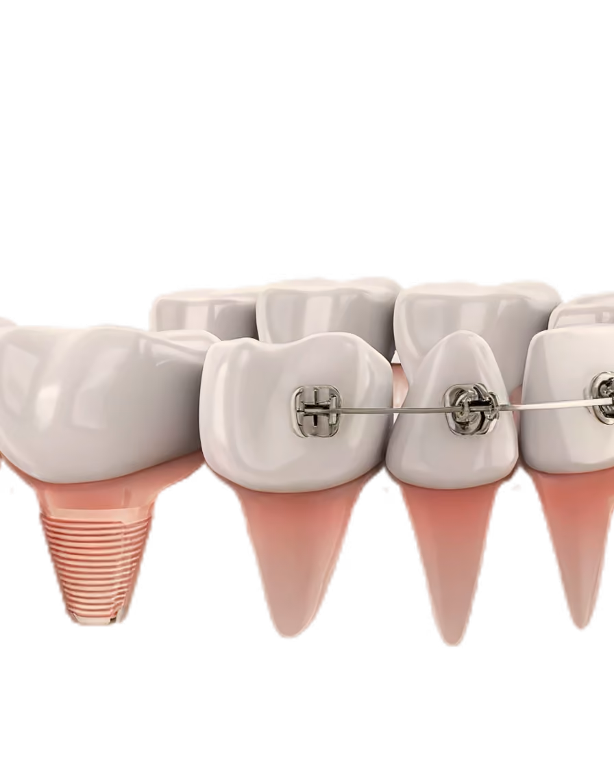 Dental tool polishing white teeth with pink gums visible underneath.